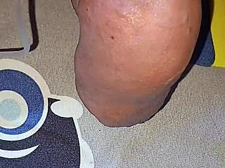 Gay Guy's Homemade Saline Injection Adventure