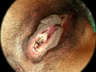 hairy pussy close up sex, what do you see?