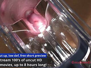 i, miss mars, am the guinea pig for electrical stim in florida hospital