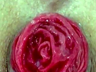 Destroyed Anal Prolapse Close Up