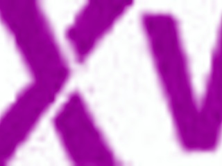 personal addicted to cocks in the ass super prolapse anal destruction alexa lewis