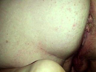 Nasty Asshole Prolapse Practice Session!