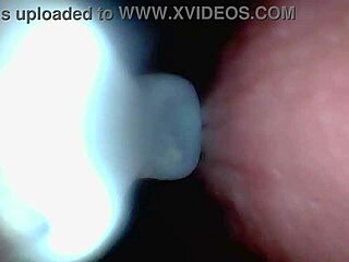 Endoscope views close-up male ejaculation inside