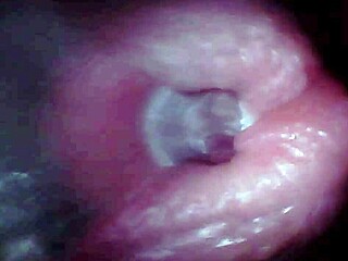 Endoscope views close-up male ejaculation inside