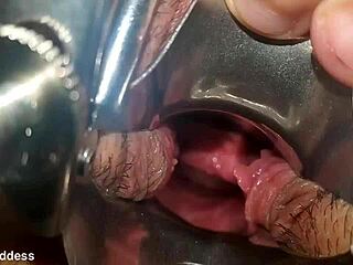 speculum in pussy close up